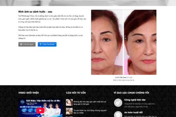 Web giới thiệu dịch vụ thẩm mỹ viện